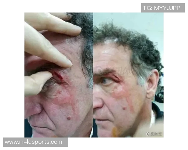 大渡口队球员王耀文因袭击裁判被禁赛五年引发热议 大渡口队球员王耀文因袭击裁判被禁赛五年引发热议